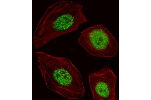 Fluorescent image of A549 cell stained with BLZF1 Antibody (Center) (ABIN653552 and ABIN2842935). (BLZF1 anticorps  (AA 156-184))