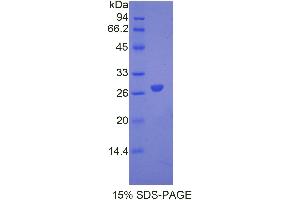 SDS-PAGE analysis of Mouse ANGPTL6 Protein. (ANGPTL6 Protéine)