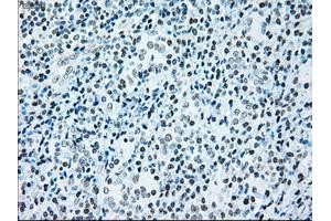 Image no. 6 for anti-B-Raf proto-oncogene, serine/threonine kinase (BRAF) antibody (ABIN1496961)