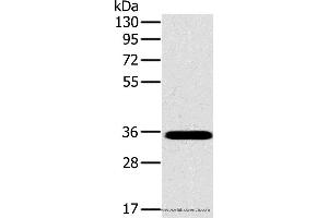 Western blot analysis of Mouse brain tissue, using OTUB1 Polyclonal Antibody at dilution of 1:800 (OTUB1 anticorps)