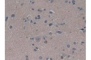 Detection of ABCC8 in Human Cerebrum Tissue using Polyclonal Antibody to ATP Binding Cassette Transporter C8 (ABCC8)