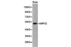 Western Blotting (WB) image for anti-Sphingomyelin phosphodiesterase 2, Neutral Membrane (Neutral Sphingomyelinase) (SMPD2) antibody (ABIN1874877) (SMPD2 anticorps)