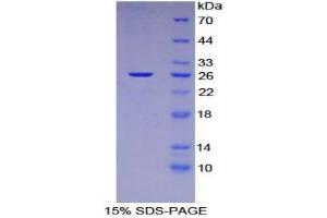 SDS-PAGE analysis of Mouse Nucleoporin 133 kDa Protein. (NUP133 Protéine)