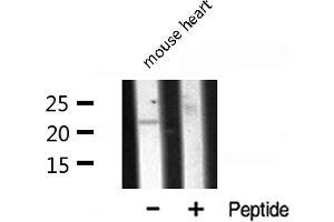 Western blot analysis of CLDN7 expression in Mouse Heart lysate (Claudin 7 anticorps  (C-Term))