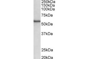 Western Blotting (WB) image for anti-serine/threonine Kinase 38 (STK38) (AA 420-431) antibody (ABIN1104516) (STK38 anticorps  (AA 420-431))