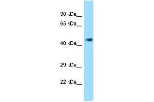 WB Suggested Anti-4732418C07Rik Antibody Titration: 1. (KIAA0494 anticorps  (C-Term))