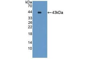 Detection of Recombinant GRPR, Mouse using Polyclonal Antibody to Gastrin Releasing Peptide Receptor (GRPR) (GRPR anticorps)