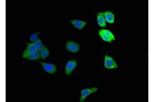 Immunofluorescence staining of HepG2 cells with ABIN7143645 at 1:166, counter-stained with DAPI.