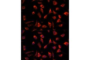 Immunofluorescence analysis of L929 cells using TCTP/TCTP/TPT1 antibody  at dilution of 1:100. (TPT1 anticorps  (AA 1-172))