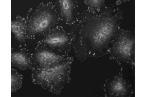 Immunofluorescent staining of A549 cells. (FAK anticorps  (pTyr397))