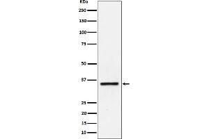 Western blot analysis of Kallikrein 8 expression in Jurkat cell lysate.