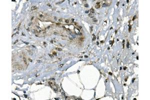 IHC analysis of JUNB using anti-JUNB antibody (ABIN7601187).