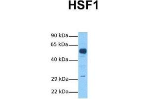 Host:  Rabbit  Target Name:  HSF1  Sample Tissue:  Human Fetal Brain  Antibody Dilution:  1. (HSF1 anticorps  (C-Term))
