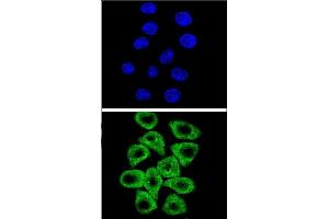 Confocal immunofluorescent analysis of CITED2 Antibody (C-term) (ABIN654133 and ABIN2844005) with Hela cell followed by Alexa Fluor® 489-conjugated goat anti-rabbit lgG (green). (CITED2 anticorps  (C-Term))