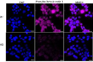 Immunocytochemical staining of HeLa cells using Phospho-beta Arrestin 1 (S412) antibody (ABIN7797654), 1:1,000), Top panel: wild-type (WT), Bottom panal: Phospho-beta Arrestin 1 (S412) shRNA knockdown (KD).