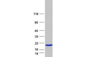 DCMP Deaminase (DCTD) (Transcript Variant 2) protein (Myc-DYKDDDDK Tag)