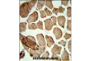 Formalin-fixed and paraffin-embedded human skeletal muscle reacted with Denatured ATG1 Antibody, which was peroxidase-conjugated to the secondary antibody, followed by DAB staining. (Denatured ATG1 anticorps)