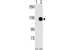 Western Blotting (WB) image for anti-TYRO3 Protein Tyrosine Kinase (TYRO3) antibody (ABIN3003422) (TYRO3 anticorps)