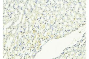 ABIN6268950 at 1/100 staining Mouse kidney tissue by IHC-P. (Dematin anticorps  (C-Term))