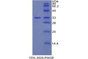 SDS-PAGE analysis of Rat AhR Protein.