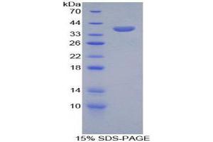 SDS-PAGE (SDS) image for serine Peptidase Inhibitor, Kazal Type 1 (SPINK1) (AA 26-78) protein (His tag,GST tag) (ABIN1879830)