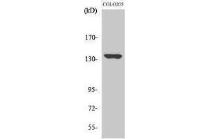 Western Blotting (WB) image for anti-MN1 proto-oncogene (MN1) (Internal Region) antibody (ABIN3185603) (Meningioma 1 anticorps  (Internal Region))