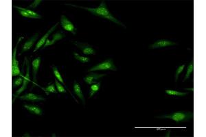 Immunofluorescence of purified MaxPab antibody to CACNB3 on HeLa cell.