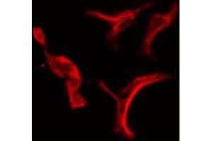 ABIN6274716 staining Hela cells by IF/ICC. (PSMD3 anticorps  (C-Term))