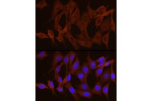 Immunofluorescence analysis of NIH/3T3 cells using PYGB Rabbit pAb  at dilution of 1:100 (40x lens).