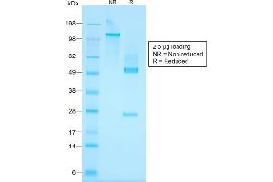 SDS-PAGE Analysis Purified Cytokeratin, HMW Rabbit Recombinant Monoclonal Antibody (KRTH/1576R).