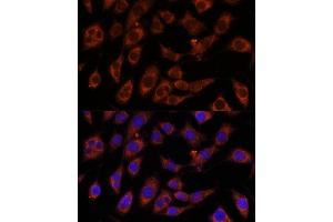 Immunofluorescence analysis of L929 cells using GFPT2 antibody (ABIN7267431) at dilution of 1:100. (GFPT2 anticorps  (AA 200-260))