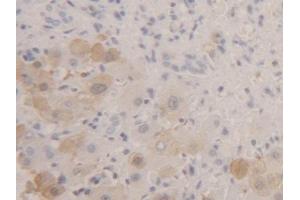 Detection of FABP1 in Human Liver Tissue using Polyclonal Antibody to Fatty Acid Binding Protein 1 (FABP1) (FABP1 anticorps  (AA 2-127))