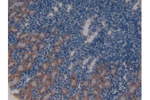IHC-P analysis of Mouse Kidney Tissue, with DAB staining. (ATM anticorps  (AA 486-742))