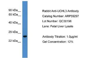 WB Suggested Anti-UCHL3  Antibody Titration: 0. (UCHL3 anticorps  (C-Term))