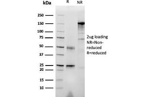 SDS-PAGE Analysis Purified RET Mouse Monoclonal Antibody (RET/2976). (Ret Proto-Oncogene anticorps  (AA 702-848))