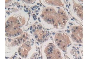 Detection of PLN in Human Stomach Tissue using Polyclonal Antibody to Phospholamban (PLN)