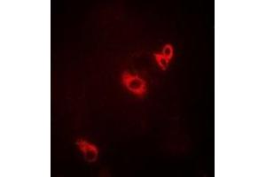 Immunofluorescent analysis of ACAD9 staining in MCF7 cells. (ACAD9 anticorps)