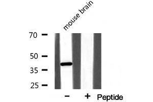 Western blot analysis on mouse brain lysate using NPM Antibody (NPM1 anticorps  (N-Term))