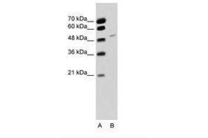 Image no. 1 for anti-RNA Binding Motif Protein 22 (RBM22) (AA 301-350) antibody (ABIN6736326) (RBM22 anticorps  (AA 301-350))
