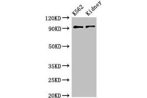 Western Blot Positive WB detected in:K562 whole cell lysate,Mouse kidney tissue All lanes:AP1G1 antibody at 3. (gamma 1 Adaptin anticorps  (AA 592-686))