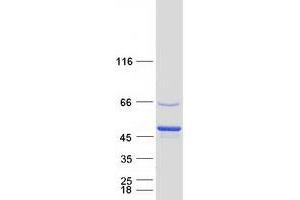 Validation with Western Blot