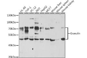 Western blot analysis of extracts of various cell lines, using Granulin antibody (ABIN6131043, ABIN6141430, ABIN6141432 and ABIN6221454) at 1:1000 dilution. (Granulin anticorps  (AA 20-310))