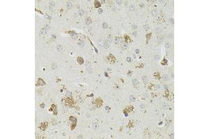 Immunohistochemistry of paraffin-embedded mouse brain using PTPN3 antibody (ABIN5973802) at dilution of 1/100 (40x lens). (PTPN3 anticorps)