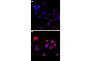 Immunocytochemistry staining of serum-starved A431 cells (A) and serum-starved A431 cells treated with Calyculin A/Okadaic Acid (B) using Phosphothreonine monoclonal antibody, clone RM102  (Red) at 1:500 dilution. (Phosphothreonine anticorps)