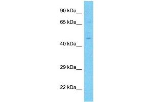 Host:  Rabbit  Target Name:  NR6A1  Sample Type:  Lymph Node Tumor lysates  Antibody Dilution:  1.