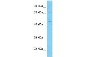 Host:  Rabbit  Target Name:  NR6A1  Sample Type:  Lymph Node Tumor lysates  Antibody Dilution:  1. (NR6A1 anticorps  (Middle Region))