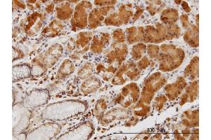 Immunoperoxidase of monoclonal antibody to LIMK1 on formalin-fixed paraffin-embedded human stomach. (LIM Domain Kinase 1 anticorps  (AA 548-647))