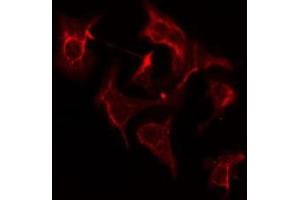 ABIN6275202 staining COLO205 cells by IF/ICC. (AASDHPPT anticorps  (C-Term))