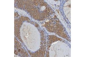 IHC analysis of mSin3A/SIN3A using anti-mSin3A/SIN3A antibody (ABIN7602504). (SIN3A anticorps  (AA 8-918))