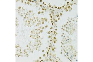 Immunohistochemistry of paraffin-embedded mouse testis using ADAR antibody.